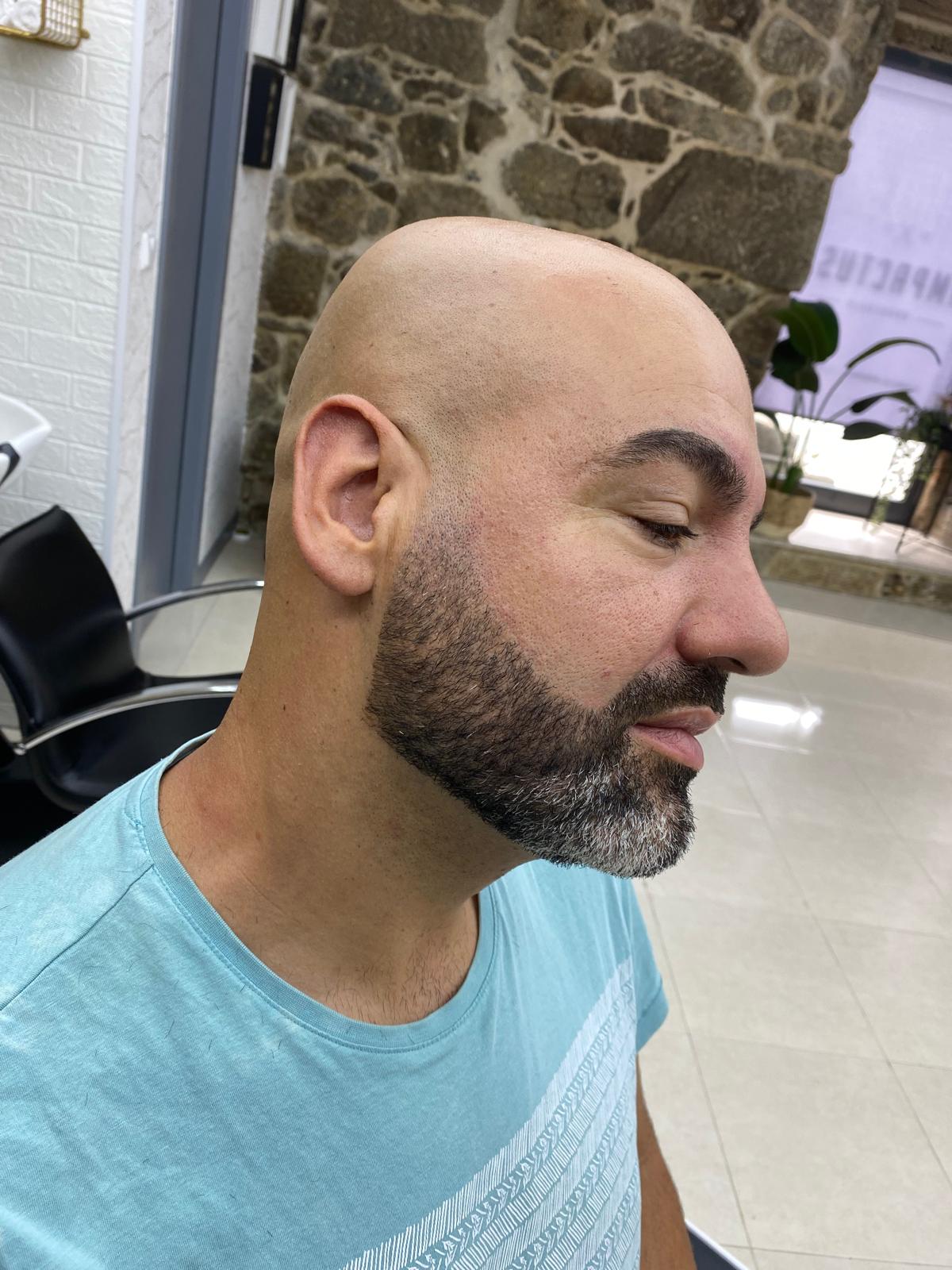 Trabalho 5